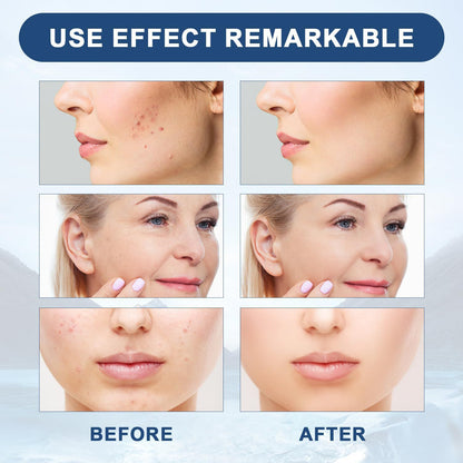 Firming Facial Essence Collagen Hydration